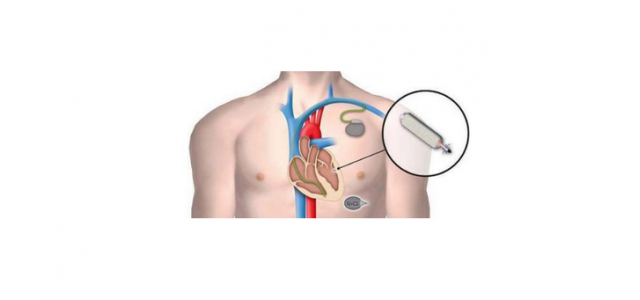 世界三大心脏起搏器品牌